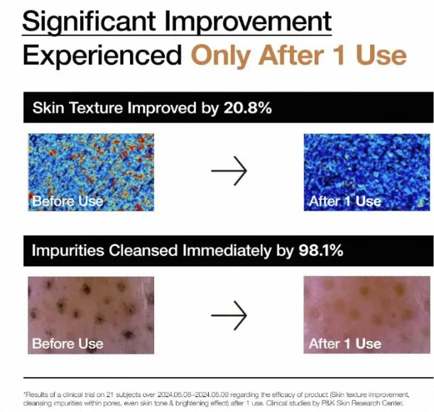 ANUA Rice Enzyme Brightening Cleansing Powder - Gentle Facial Wash for Radiant Skin, Korean Exfoliating Rice Mask with Ceramide