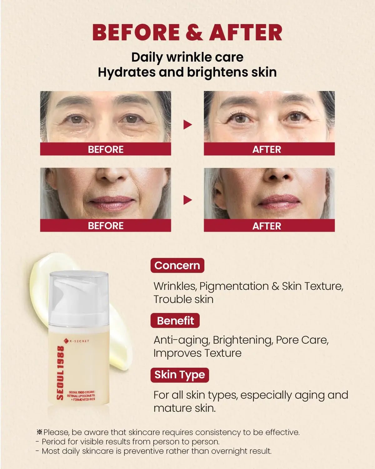 KSECRET SEOUL 1988 Cream : Retinal Liposome 1% + Fermented Rice 50ml Korean Skin Care Cream Private Label - Skin Glowing