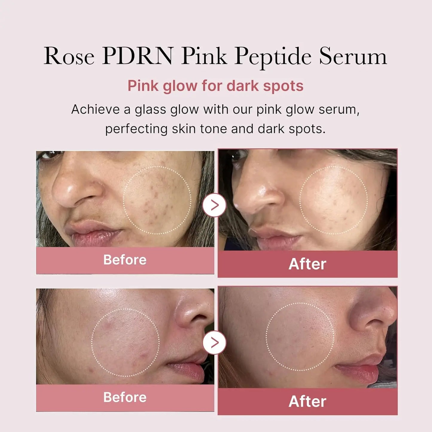 Medicube PDRN PINK PEPTIDE SERUM 30ml Korean Skin Care Serum Private Label Pdrn Serum Ampoule