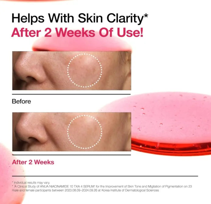 Korean Skin Care ANUA Niacinamide 10 + TXA 4 Serum Hyaluronic Acid Tranexamic acid Vitamin B12 Face Serum for Glass Skin