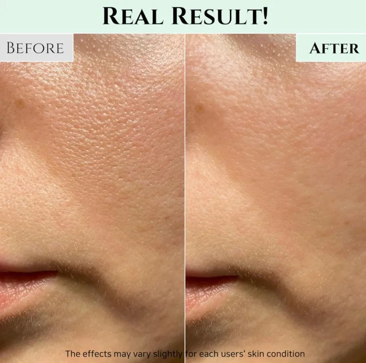 Korea Skincare Green Plum Refreshing Cleanser Gel Type Deep Pore Cleansing Acne Face Wash Blackhead Remover