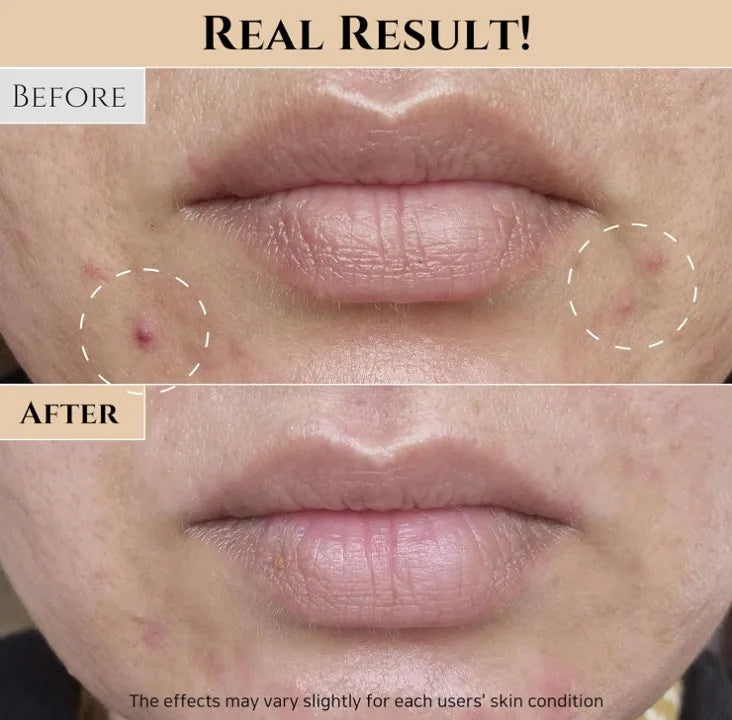 Korea Skincare Beauty toner Glow Replenishing Rice Facial Toner for Oily Combination Skin Toner